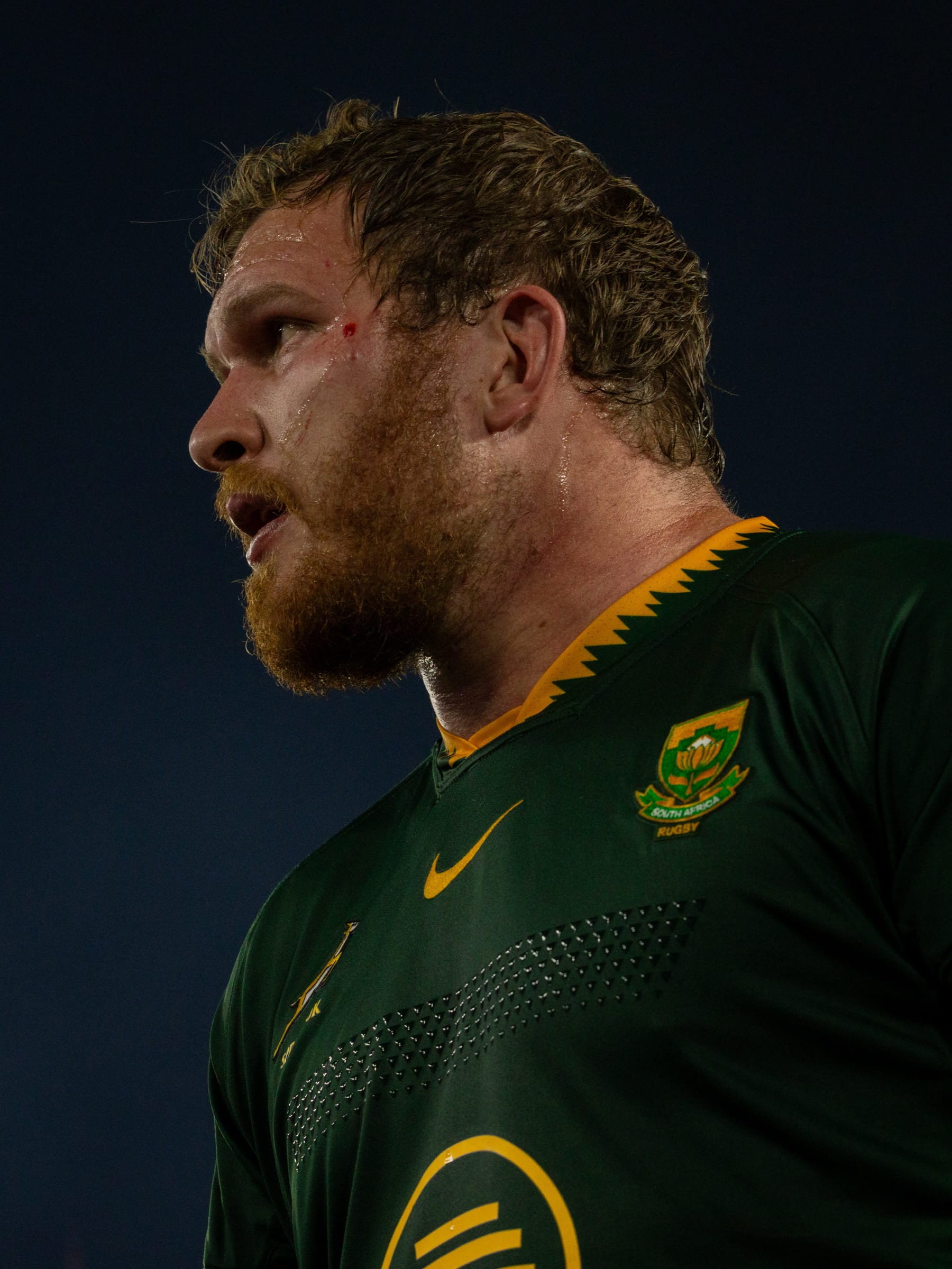 Springboks player in a green and gold jersey looking on during a match